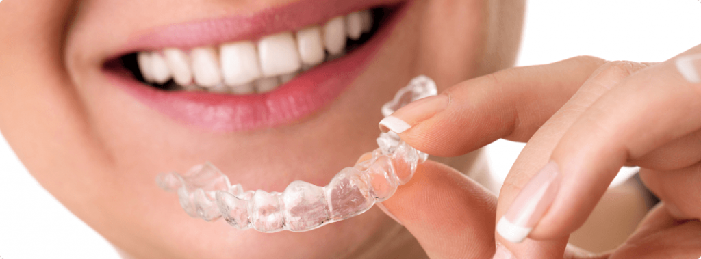 Как правильно провести диагностику для элайнеров, и получить здоровые и красивые зубы?